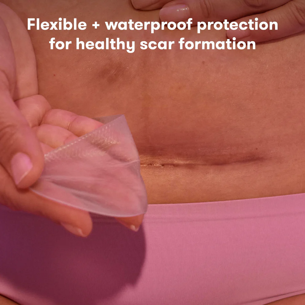 Fridamom C section silicone scar patch - 6p